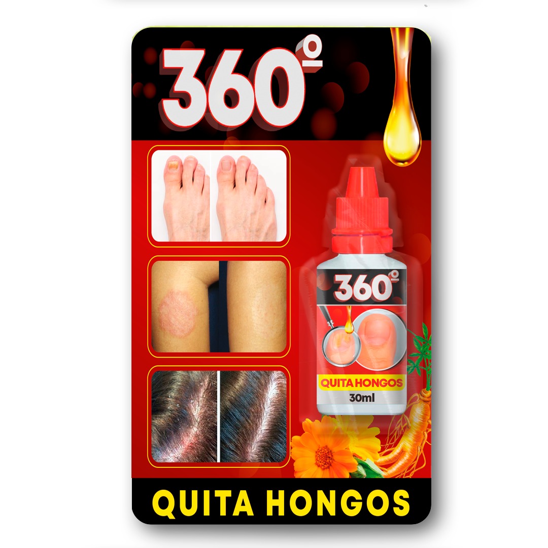 QUITA HONGOS 360 ROJO